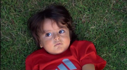 2 5 Yaş Sendromu Belirtileri ve Tedavisi