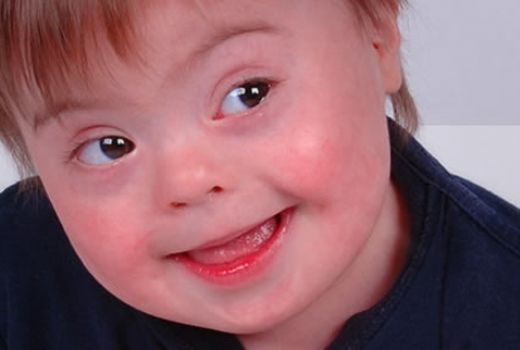 Doğum Sendromu Neden Olur?