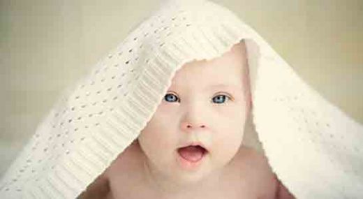 Down Sendromu Genetik mi?