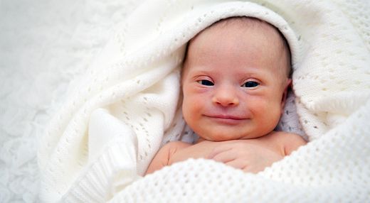 Down Sendromu Nasıl Anlaşılır?