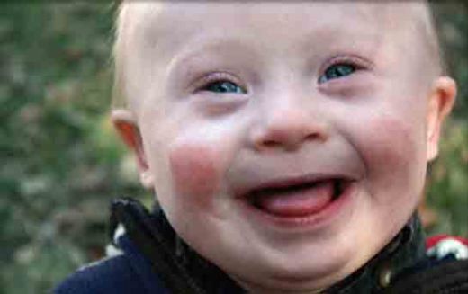 Down Sendromu Riski Kaç Olmalı?