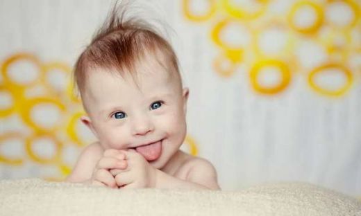 Down Sendromu Testi Değerleri