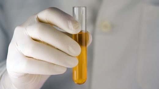 Fanconi Sendromu Belirtileri ve Tedavisi