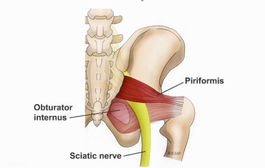 Piriformis Sendromu Belirtileri ve Tedavisi